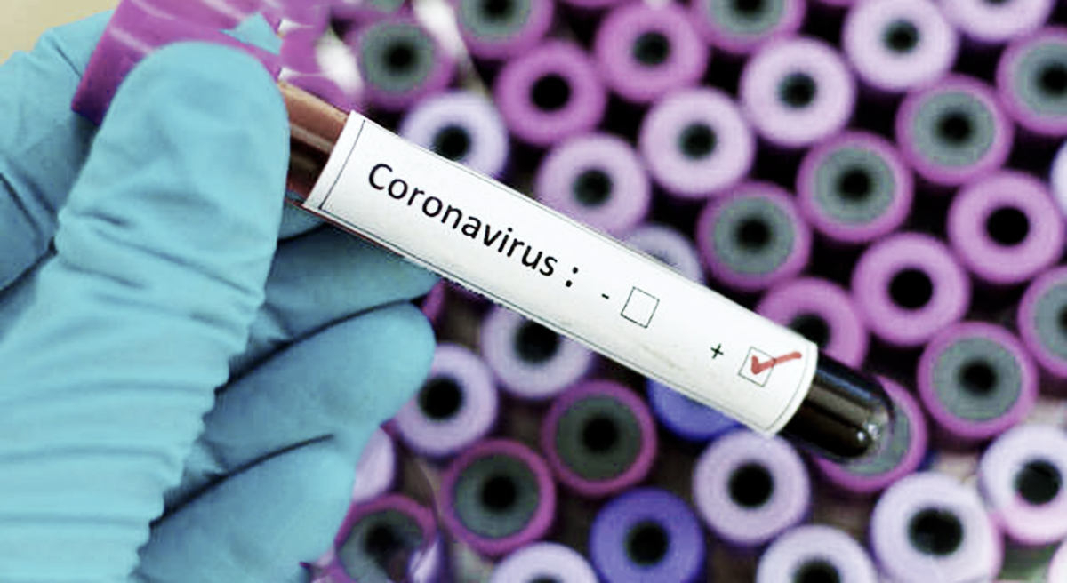 Coronavirus